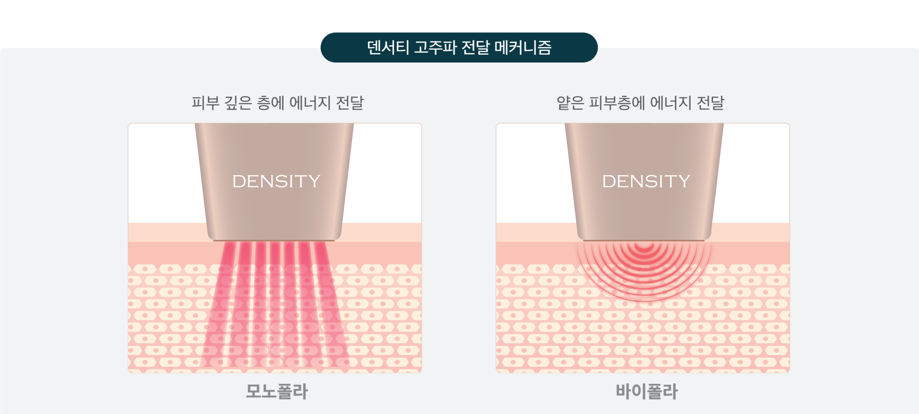 덴서티 고주파 전달 메커니즘 : 모노폴라는 피부 깊은 층, 바이폴라는 얕은 피부층에 에너지 전달