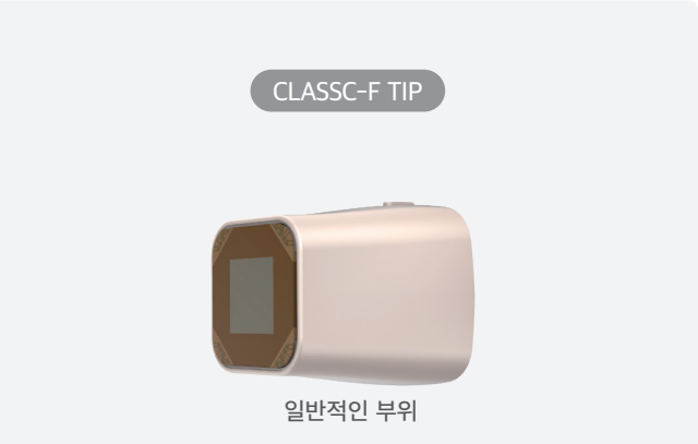 CLASSC-F TIP : 일반적인 부위