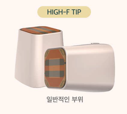 HIGH-F TIP : 일반적인 부위